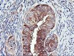 PFKP Antibody in Immunohistochemistry (Paraffin) (IHC (P))