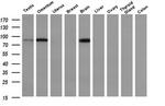 PFKP Antibody in Western Blot (WB)