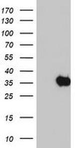 SDS Antibody in Western Blot (WB)