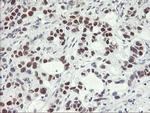 OBFC2B Antibody in Immunohistochemistry (Paraffin) (IHC (P))