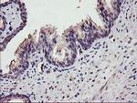 DGKA Antibody in Immunohistochemistry (Paraffin) (IHC (P))