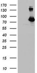 DGKA Antibody in Western Blot (WB)