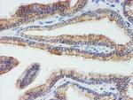 DGKA Antibody in Immunohistochemistry (Paraffin) (IHC (P))