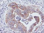 DGKA Antibody in Immunohistochemistry (Paraffin) (IHC (P))