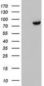 DGKA Antibody in Western Blot (WB)