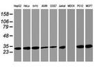 PSMA4 Antibody in Western Blot (WB)