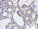 GSTO2 Antibody in Immunohistochemistry (Paraffin) (IHC (P))