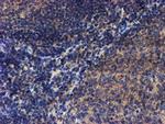 LECT2 Antibody in Immunohistochemistry (Paraffin) (IHC (P))