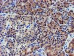 LECT2 Antibody in Immunohistochemistry (Paraffin) (IHC (P))