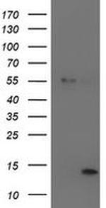 LECT2 Antibody in Western Blot (WB)