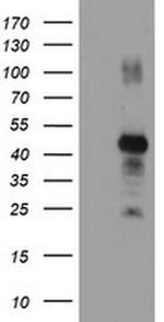 RNF113B Antibody in Western Blot (WB)