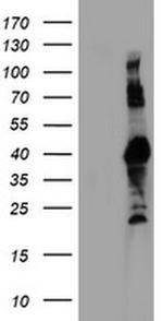 RNF113B Antibody in Western Blot (WB)