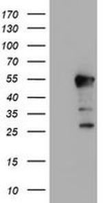 ERI1 Antibody in Western Blot (WB)