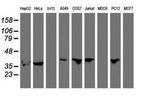 ERI1 Antibody in Western Blot (WB)