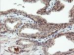 AGPAT5 Antibody in Immunohistochemistry (Paraffin) (IHC (P))