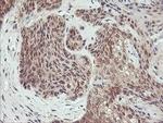 AGPAT5 Antibody in Immunohistochemistry (Paraffin) (IHC (P))