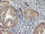 AGPAT5 Antibody in Immunohistochemistry (Paraffin) (IHC (P))