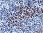 J Chain Antibody in Immunohistochemistry (Paraffin) (IHC (P))