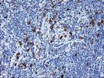 J Chain Antibody in Immunohistochemistry (Paraffin) (IHC (P))