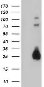 J Chain Antibody in Western Blot (WB)