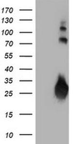 J Chain Antibody in Western Blot (WB)