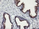 Kir3.1 (KCNJ3) Antibody in Immunohistochemistry (Paraffin) (IHC (P))