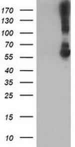 Kir3.1 (KCNJ3) Antibody in Western Blot (WB)