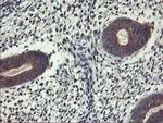 ALG2 Antibody in Immunohistochemistry (Paraffin) (IHC (P))