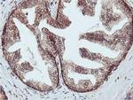 C20orf3 Antibody in Immunohistochemistry (Paraffin) (IHC (P))