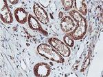 C20orf3 Antibody in Immunohistochemistry (Paraffin) (IHC (P))