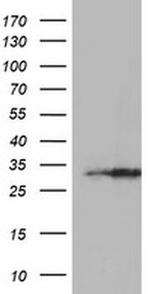 EXOSC7 Antibody in Western Blot (WB)