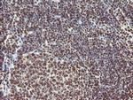 EXOSC7 Antibody in Immunohistochemistry (Paraffin) (IHC (P))