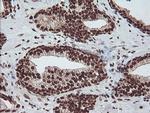 EXOSC7 Antibody in Immunohistochemistry (Paraffin) (IHC (P))