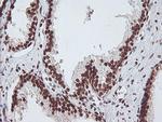 EXOSC7 Antibody in Immunohistochemistry (Paraffin) (IHC (P))