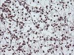 EXOSC7 Antibody in Immunohistochemistry (Paraffin) (IHC (P))