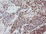 EXOSC7 Antibody in Immunohistochemistry (Paraffin) (IHC (P))