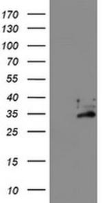 EXOSC7 Antibody in Western Blot (WB)