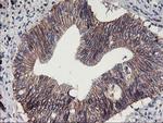 ALOX15 Antibody in Immunohistochemistry (Paraffin) (IHC (P))