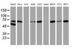 ALOX15 Antibody in Western Blot (WB)