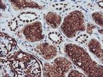 CD249 Antibody in Immunohistochemistry (Paraffin) (IHC (P))