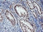 CD249 Antibody in Immunohistochemistry (Paraffin) (IHC (P))