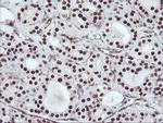 CD249 Antibody in Immunohistochemistry (Paraffin) (IHC (P))