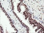 CD249 Antibody in Immunohistochemistry (Paraffin) (IHC (P))