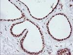 CD249 Antibody in Immunohistochemistry (Paraffin) (IHC (P))