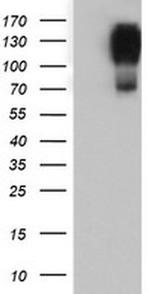 CD249 Antibody in Western Blot (WB)