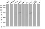 Iduronate 2 Sulfatase Antibody in Western Blot (WB)