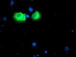 Iduronate 2 Sulfatase Antibody in Immunocytochemistry (ICC/IF)