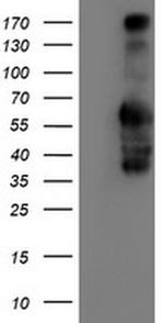 Iduronate 2 Sulfatase Antibody in Western Blot (WB)