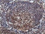 RUVBL2 Antibody in Immunohistochemistry (Paraffin) (IHC (P))