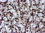 RUVBL2 Antibody in Immunohistochemistry (Paraffin) (IHC (P))